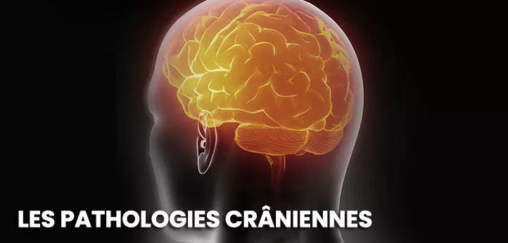 Pathologies craniennes Tunisie